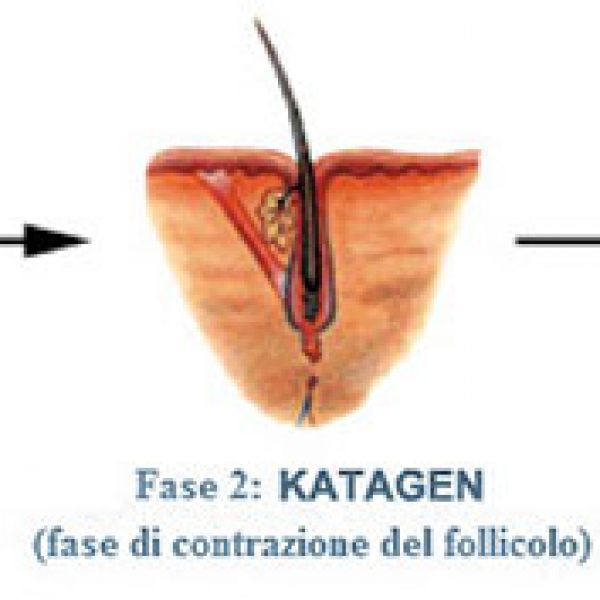 EPILAZIONE LASER PERMANENTE