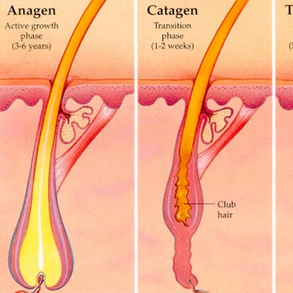 EPILAZIONE LASER PERMANENTE