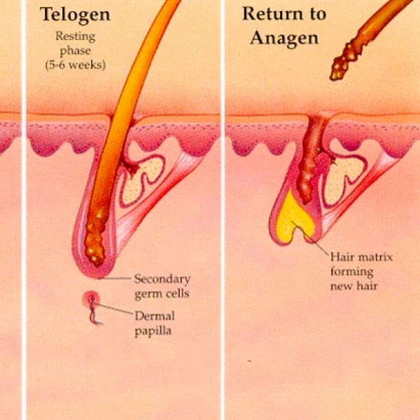 EPILAZIONE LASER PERMANENTE