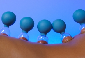 Cupping Massage 